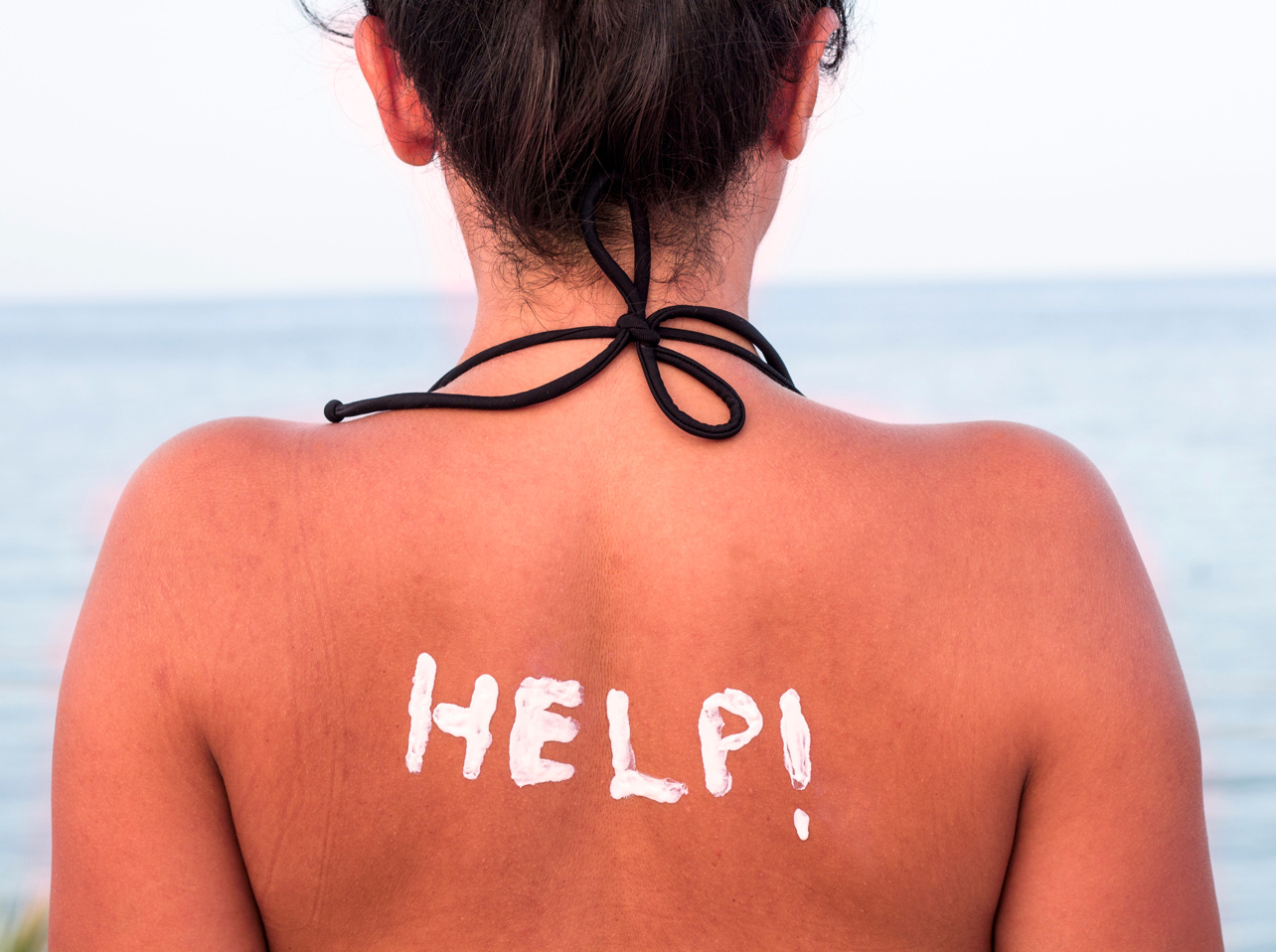 Natural Sunburn Remedies that are Effective, Easy and Work Fast!